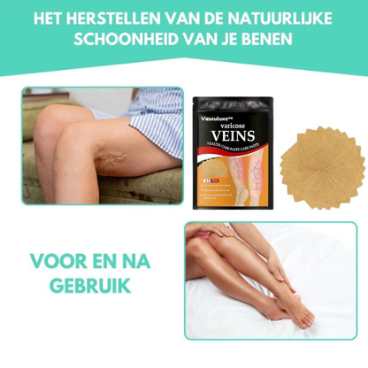 Vasculuxe™